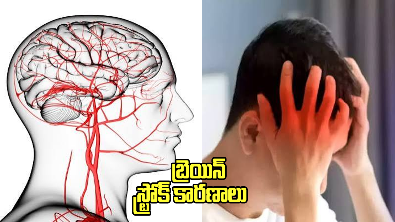don't do these mistakes for avoiding brain stroke issues